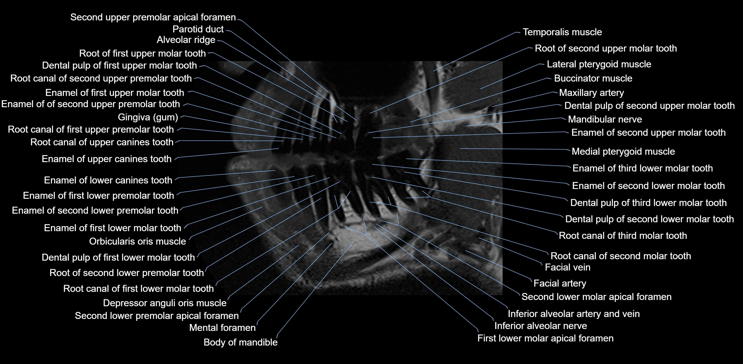 Dental MRI( tooth) sagittal labelled  cross sectional 3T anatomy -img-00001-00006.webp